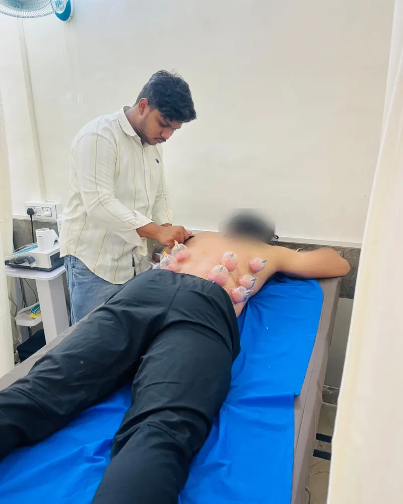 Cupping therapy in progress in a treatment room at Dynamics Mend physiotherapy clinic, Sector 52 Noida