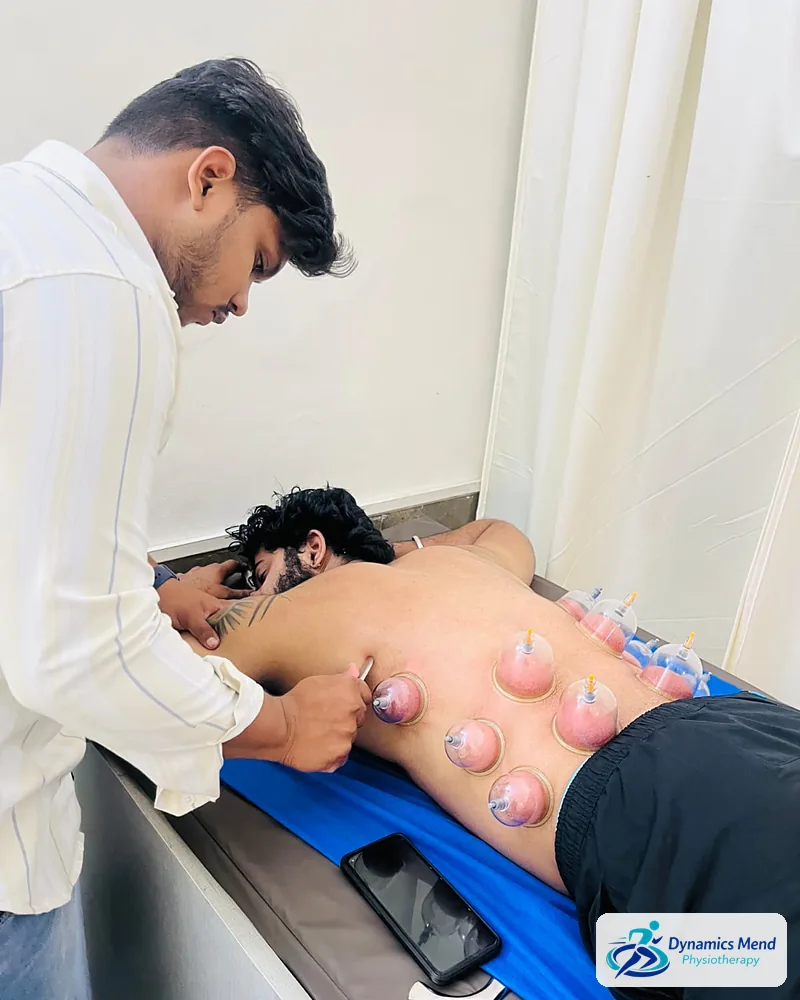 Physiotherapist placing suction cups along a patient's back during dry cupping at Dynamics Mend, Sector 52 Noida